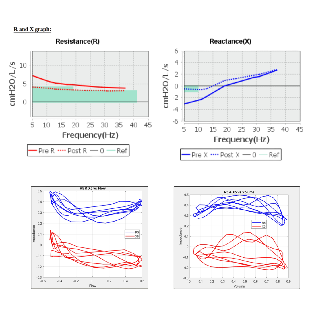 Antlia Pro Device Software Solutions